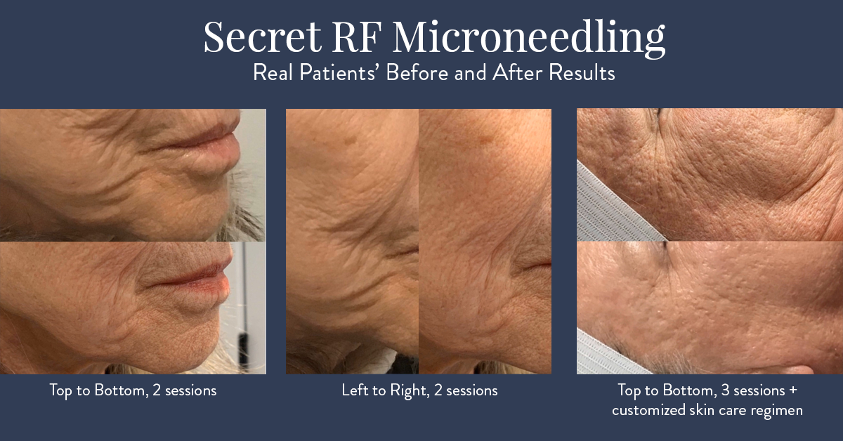The Secret To Beautiful Skin The Secret To Beautiful Skin