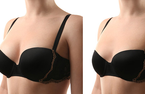 Side-by-side views of a woman in a black bra, with larger breasts in the left-hand photo.
