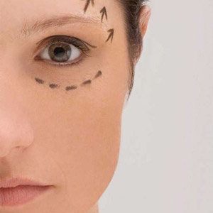 Close-up of the left side of a woman\'s face with a dotted black line drawn below her eye and arrows drawn above her brow.