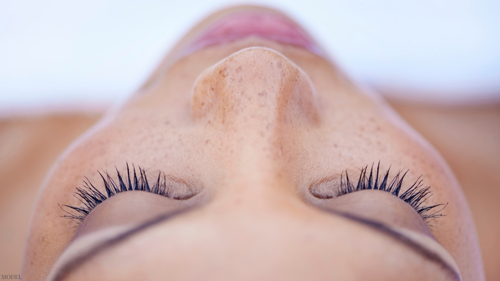 Woman with rhinoplasty in Latham, NY.