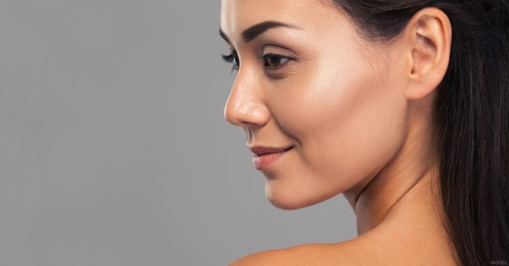 Profile view of a woman after a rhinoplasty procedure (model).
