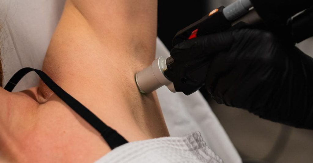 Laser hair removal treatment on the underarms
