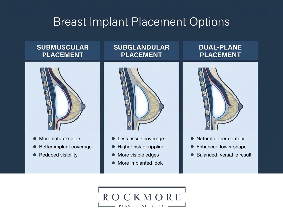 Infographic titled “Breast Implant Placement Options” comparing three implant placement techniques with side-view breast anatomy illustrations. The graphic includes: “Submuscular Placement” with benefits listed as more natural slope, better implant coverage, and reduced visibility; “Subglandular Placement” noting less tissue coverage, higher risk of rippling, and more visible edges; and “Dual-Plane Placement” highlighting natural upper contour, enhanced lower shape, and balanced, versatile results. Rockmore Plastic Surgery logo appears at the bottom.