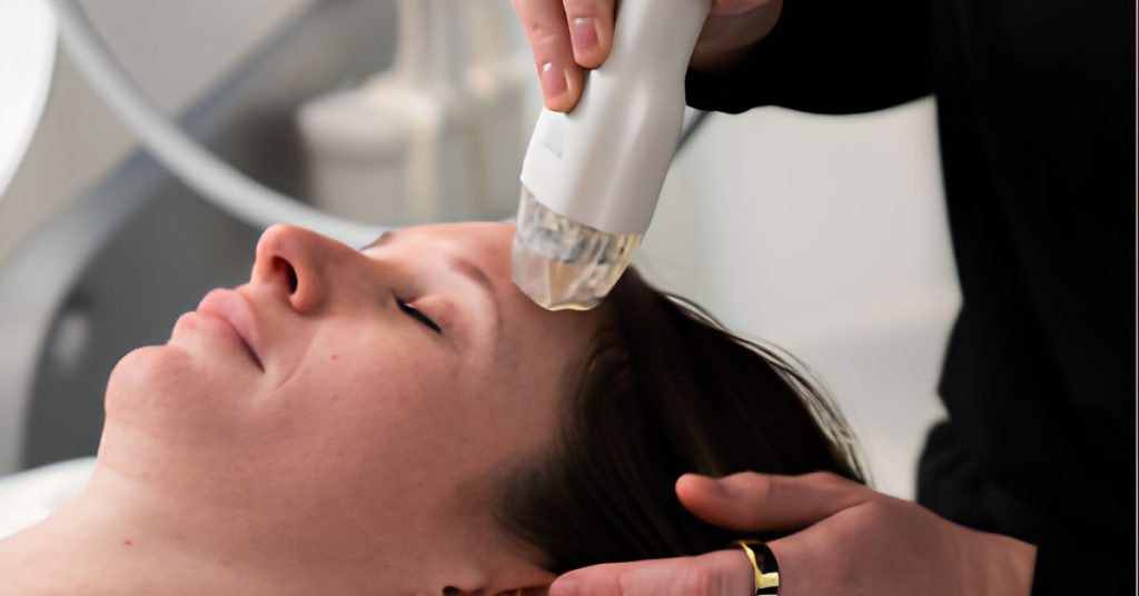 VirtueRF treatment