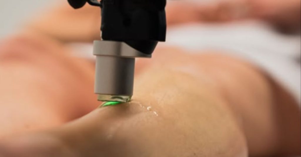 Laser Hair Removal treatment